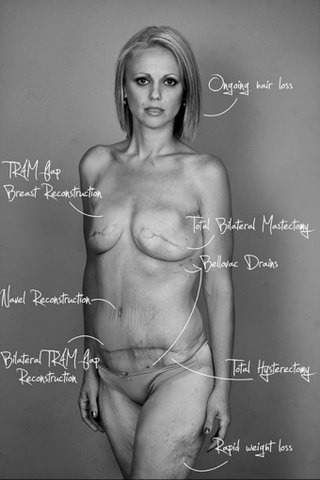Illustration for article titled Breast Cancer Survivor Goes Naked on Facebook to Raise Awareness